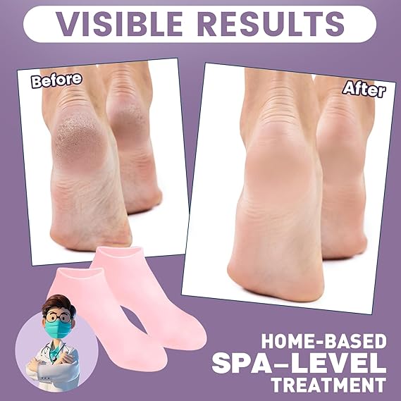 Silicone Socks for Dry Cracked Feet ,for Moisturizing, Cracked Heel Treatment