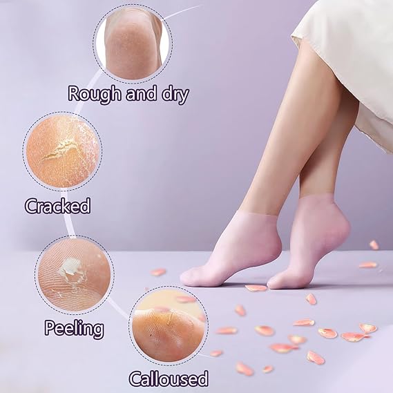Silicone Socks for Dry Cracked Feet ,for Moisturizing, Cracked Heel Treatment