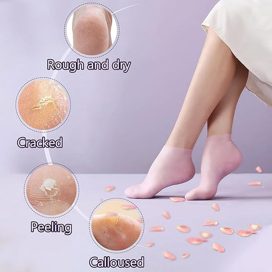 Silicone Socks for Dry Cracked Feet ,for Moisturizing, Cracked Heel Treatment